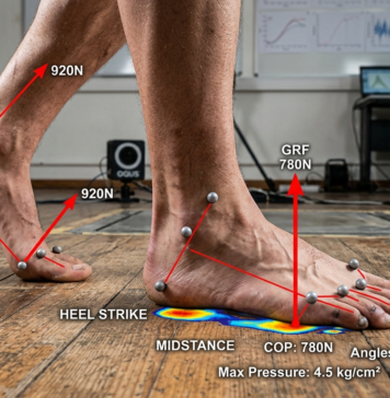 Biomechanika chůze a co se může měnit